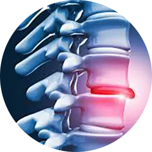 Disc Injuries